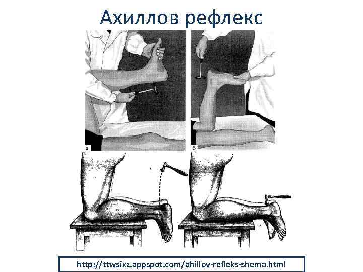 Ахиллов рефлекс http: //ttwsixz. appspot. com/ahillov-refleks-shema. html 