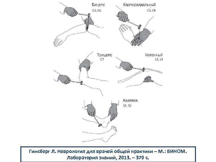 Гинсберг Л. Неврология для врачей общей практики – М. : БИНОМ. Лаборатория знаний, 2013.