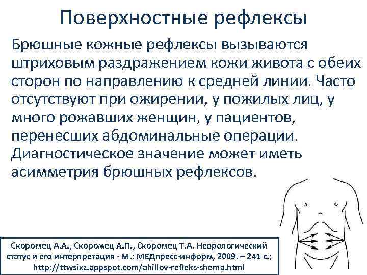 Поверхностные рефлексы Брюшные кожные рефлексы вызываются штриховым раздражением кожи живота с обеих сторон по