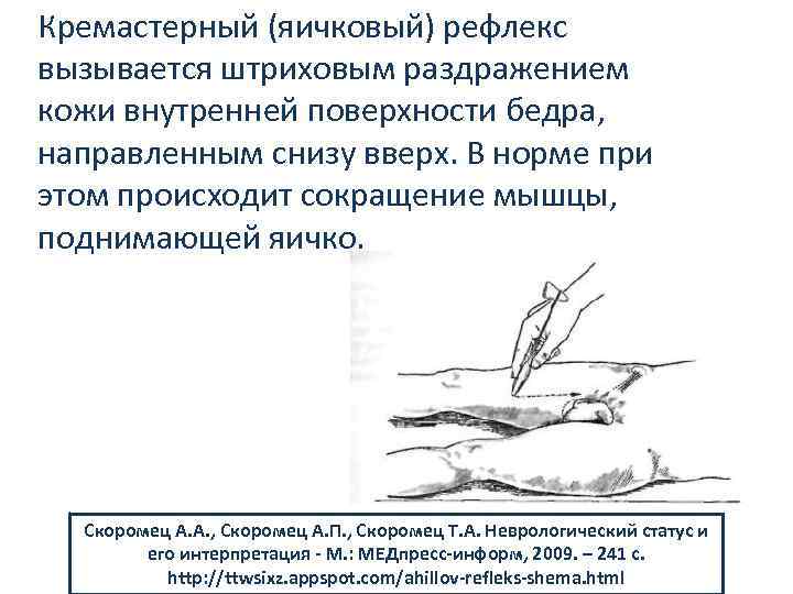 Кремастерный (яичковый) рефлекс вызывается штриховым раздражением кожи внутренней поверхности бедра, направленным снизу вверх. В