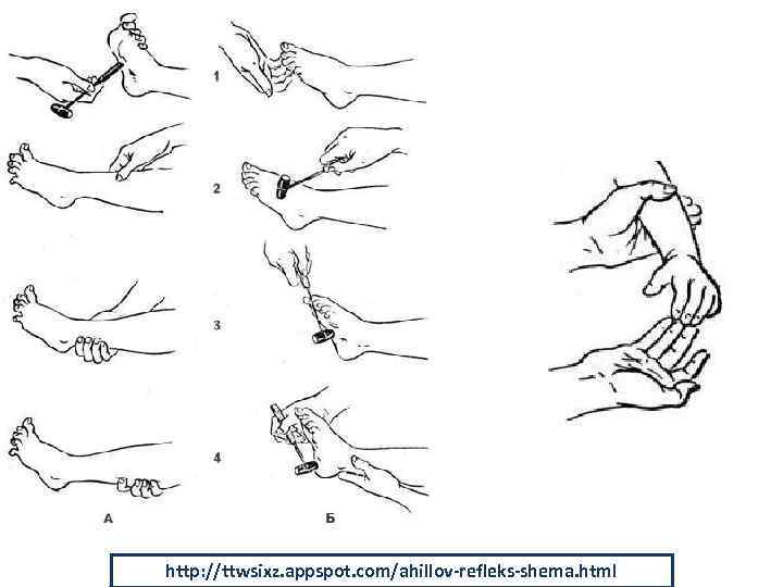 http: //ttwsixz. appspot. com/ahillov-refleks-shema. html 