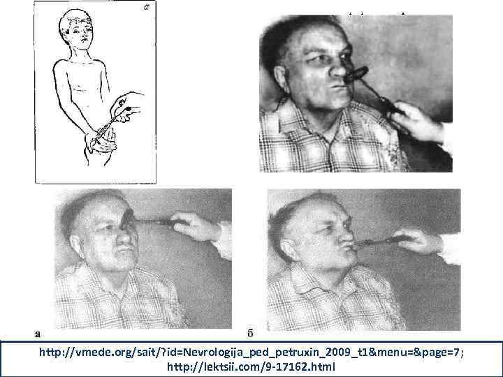 http: //vmede. org/sait/? id=Nevrologija_ped_petruxin_2009_t 1&menu=&page=7; http: //lektsii. com/9 -17162. html 