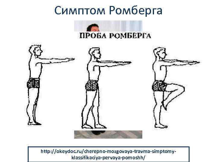 Симптом Ромберга http: //edikst. ru/article/264711/poza-romberga---chto-eto-takoehttp: //okeydoc. ru/cherepno-mozgovaya-travma-simptomyvestibulyarnaya-proba-v-poze-romberga klassifikaciya-pervaya-pomoshh/ 