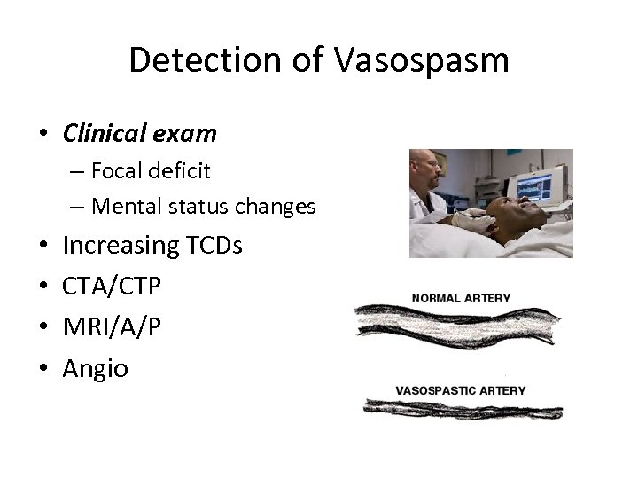 Detection of Vasospasm • Clinical exam – Focal deficit – Mental status changes •