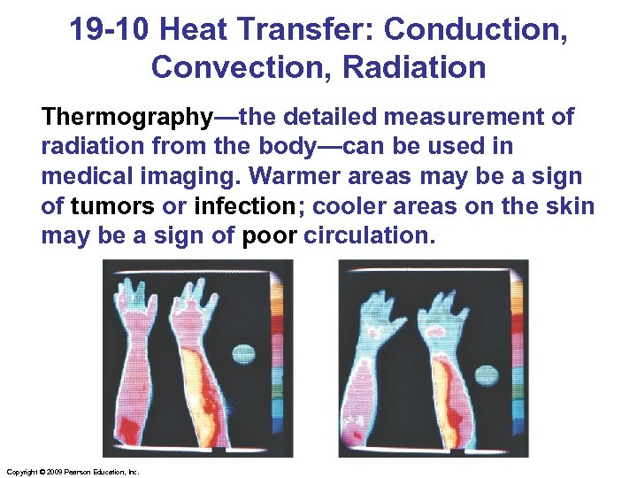 19 -10 Heat Transfer: Conduction, Convection, Radiation Thermography—the detailed measurement of radiation from the