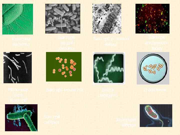Кишечна паличка Молочнок ислі бактерії Бактерії на дні океана Бактерії менінгіта Бактерії сибірки Бактерії