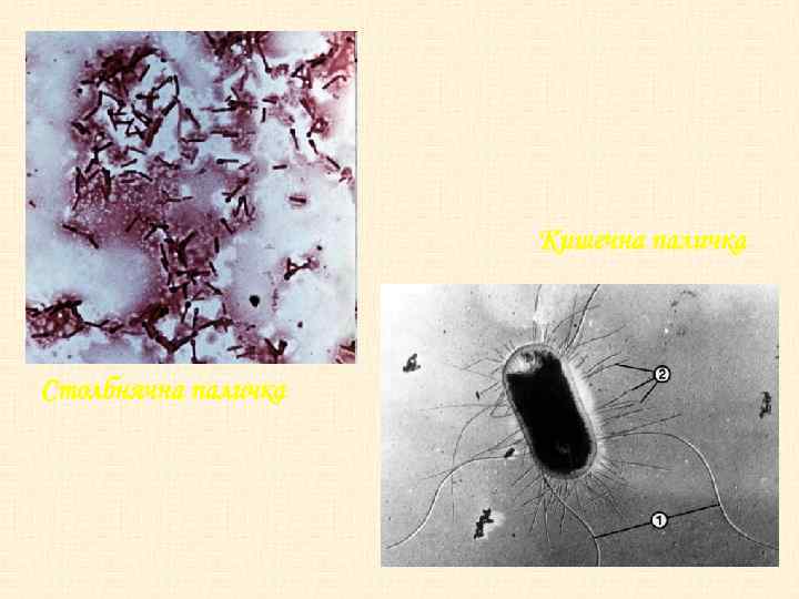 Кишечна паличка Столбнячна паличка 