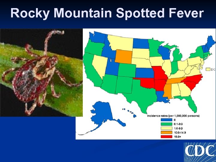 Rocky Mountain Spotted Fever 