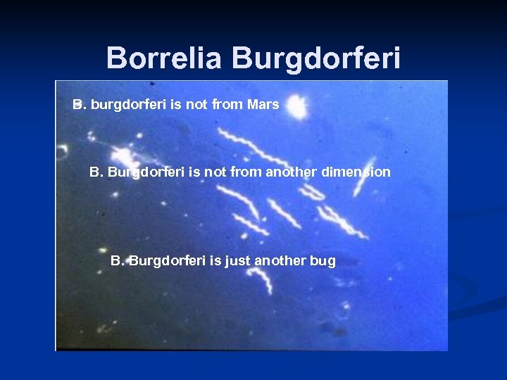 Borrelia Burgdorferi B. burgdorferi is not from Mars B. Burgdorferi is not from another