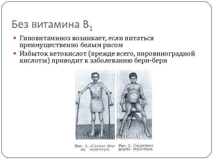 Без витамина В 1 Гиповитаминоз возникает, если питаться преимущественно белым рисом Избыток кетокислот (прежде