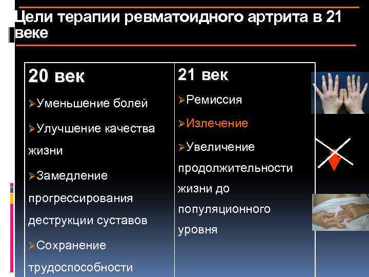 Цели терапии ревматоидного артрита в 21 веке 20 век 21 век ØУменьшение болей ØРемиссия