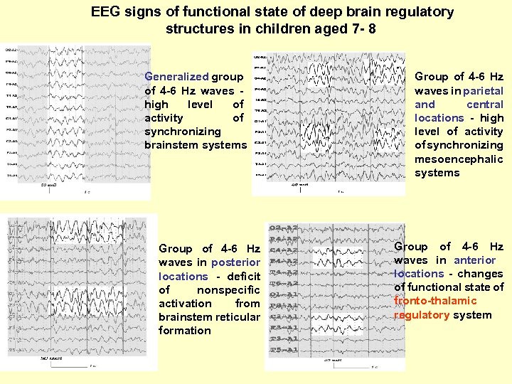 EEG signs of functional state of deep brain regulatory structures in children aged 7