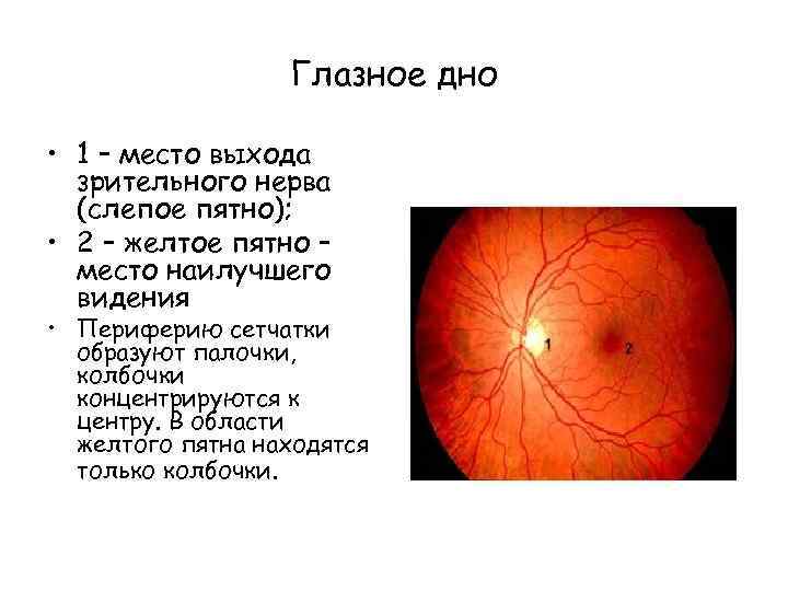 Зона выхода зрительного нерва. Слепое пятно офтальмология. Глазное дно слепое пятно. Слепое пятно это место выхода зрительного нерва.