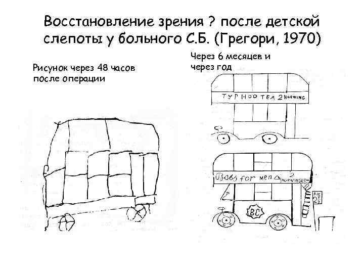 Восстановление зрения ? после детской слепоты у больного С. Б. (Грегори, 1970) Рисунок через