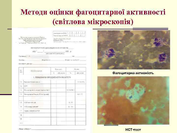 Методи оцінки фагоцитарної активності (світлова мікроскопія) Фагоцитарна активність НСТ-тест 