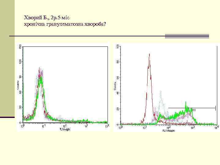 Хворий Б. , 2 р. 5 міс хронічна гранулематозна хвороба? 