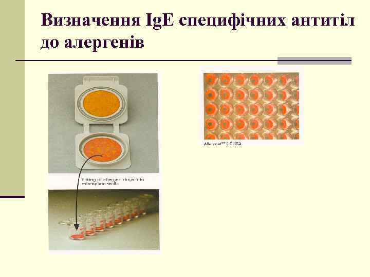 Визначення Ig. E специфічних антитіл до алергенів 