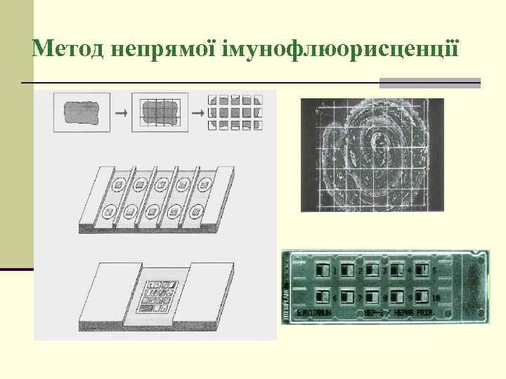 Метод непрямої імунофлюорисценції 