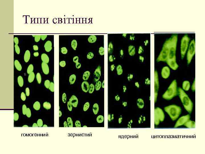 Типи світіння гомогенний зернистий ядерний цитоплазматичний 