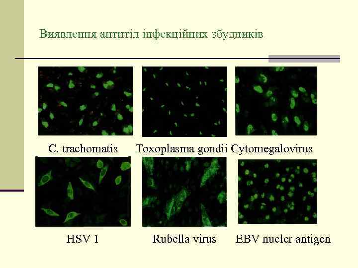 Виявлення антитіл інфекційних збудників C. trachomatis HSV 1 Toxoplasma gondii Cytomegalovirus Rubella virus EBV