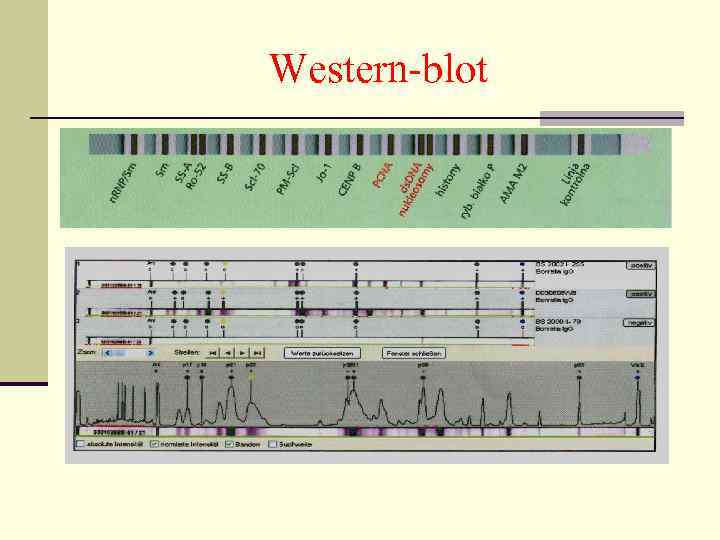Western-blot 