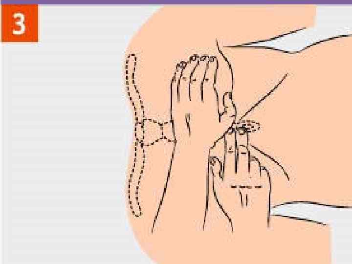 1. Обнажите грудную клетку. Нижнюю ладонь положите перпендикулярно грудине, а другую поверх первой ладони