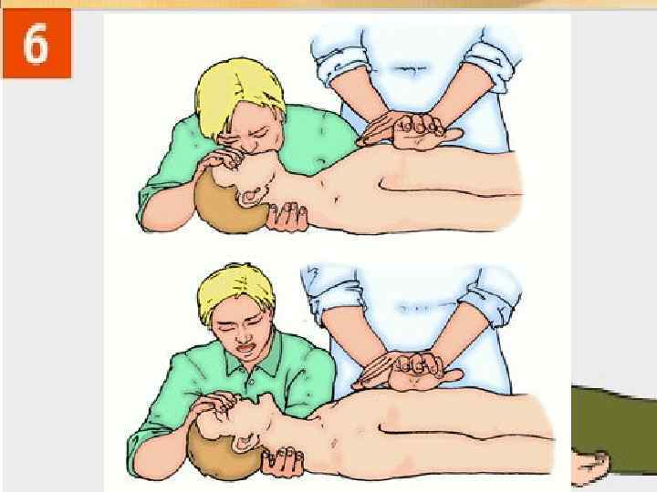 После первых 30 нажатий сделайте 2 вдоха. Каждые 3 минуты проверяйте пульс. Для детей: