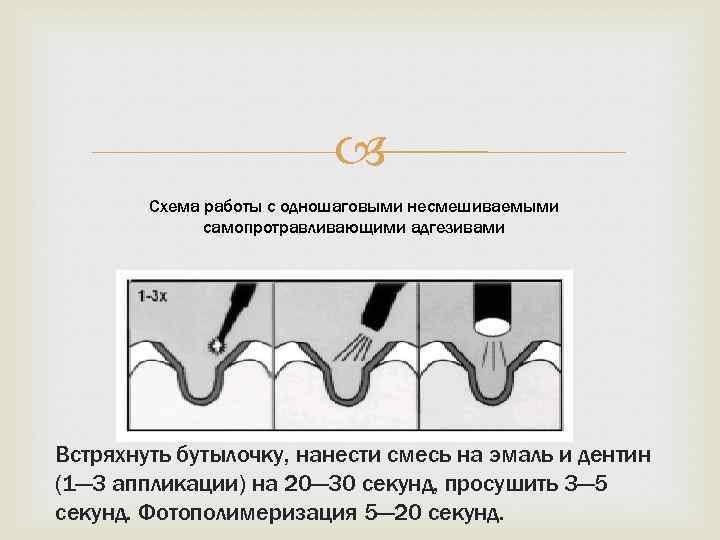 Адгезивная система презентация