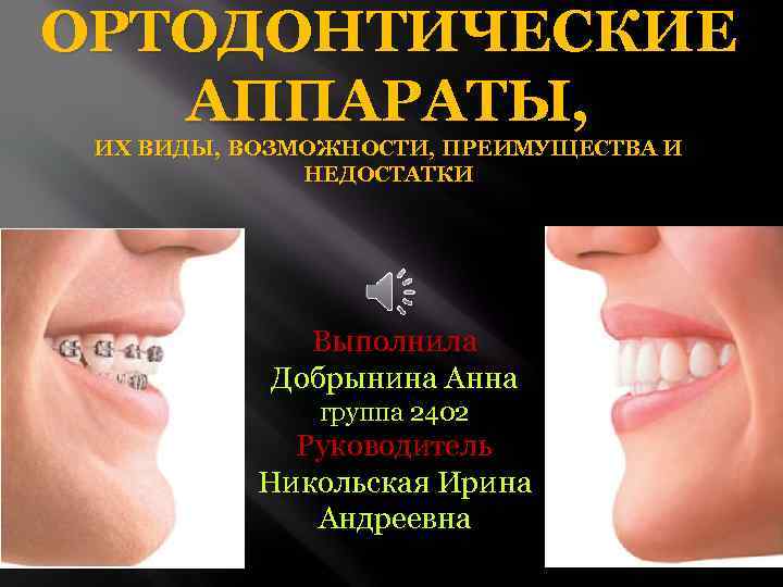ОРТОДОНТИЧЕСКИЕ АППАРАТЫ, ИХ ВИДЫ, ВОЗМОЖНОСТИ, ПРЕИМУЩЕСТВА И НЕДОСТАТКИ Выполнила Добрынина Анна группа 2402 Руководитель