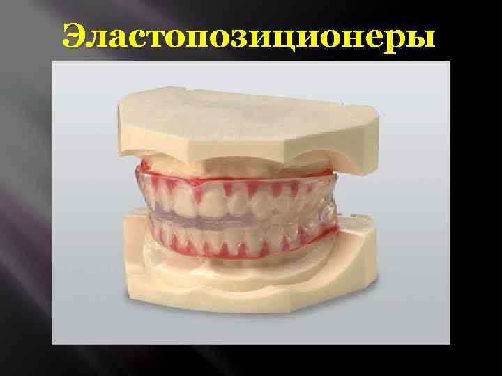 Эластопозиционеры 