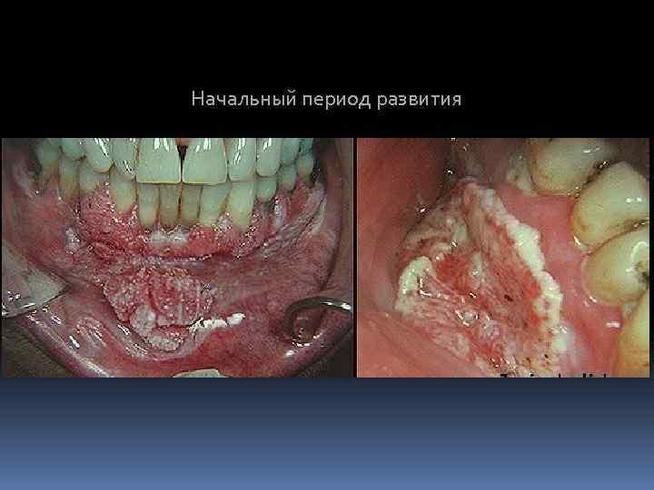 Начальный период развития 