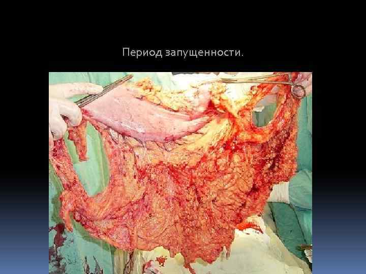 Период запущенности. 