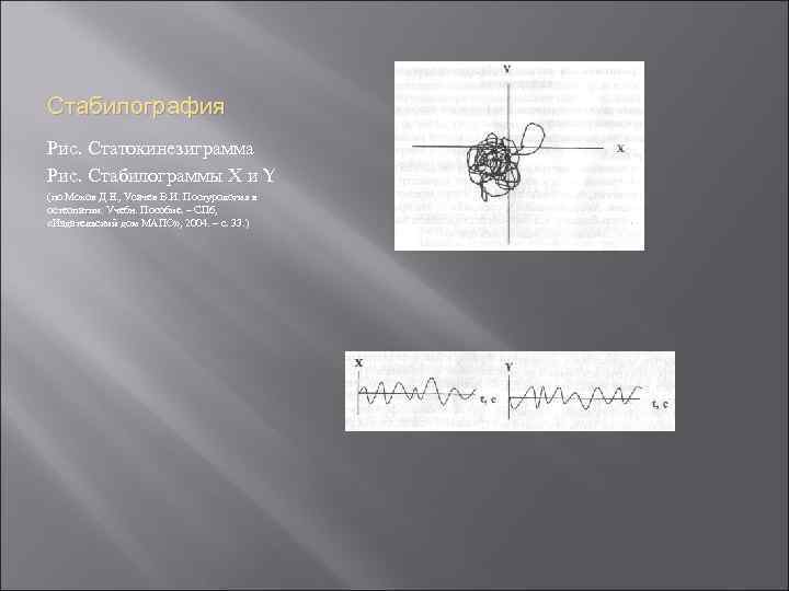 Стабилография Рис. Статокинезиграмма Рис. Стабилограммы Х и Y (по Мохов Д. Е. , Усачев