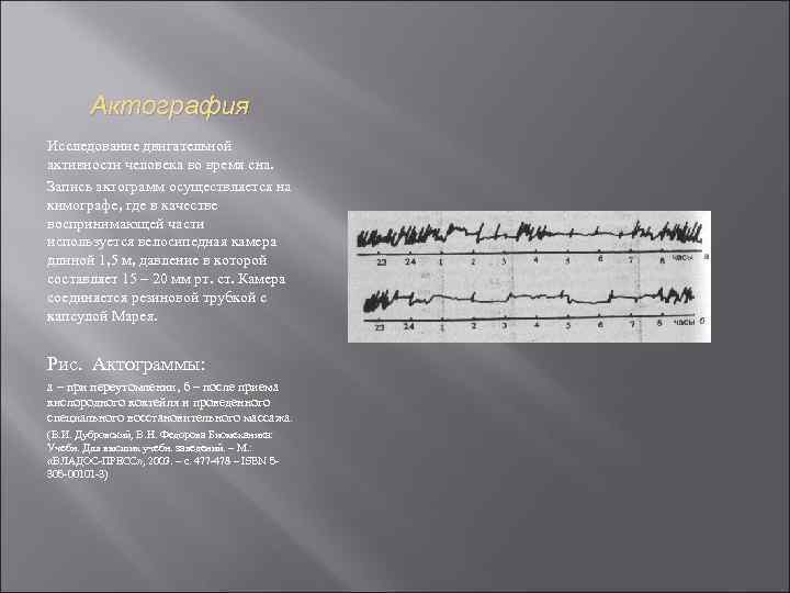 Актография Исследование двигательной активности человека во время сна. Запись актограмм осуществляется на кимографе, где