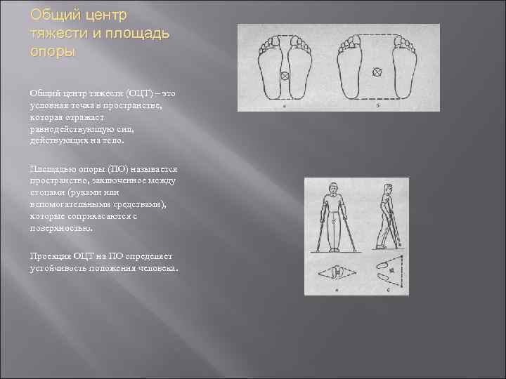 Общий центр тяжести и площадь опоры Общий центр тяжести (ОЦТ) – это условная точка