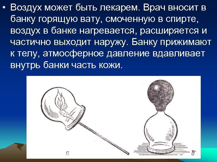  • Воздух может быть лекарем. Врач вносит в банку горящую вату, смоченную в