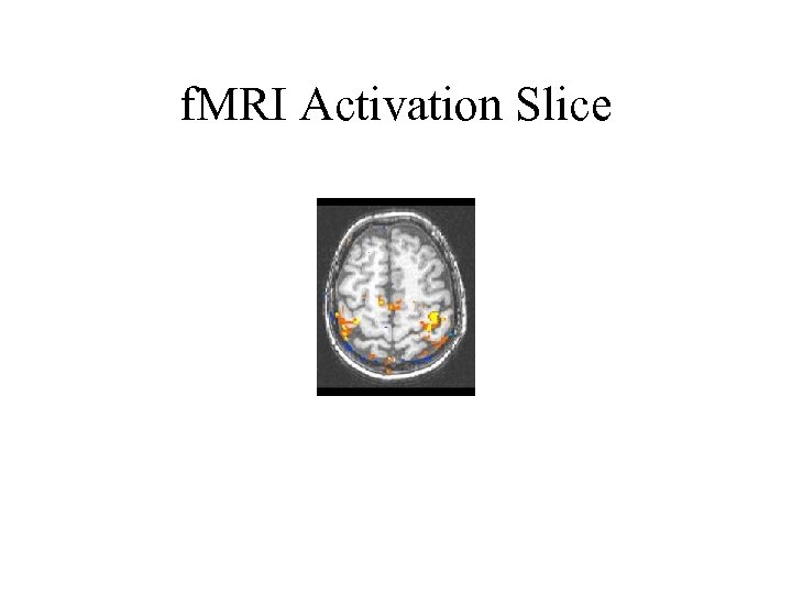 f. MRI Activation Slice 