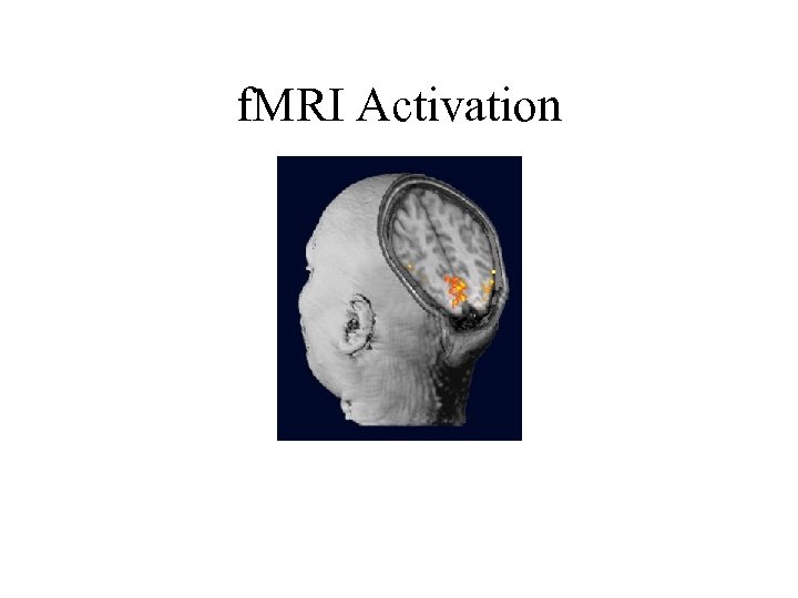 f. MRI Activation 