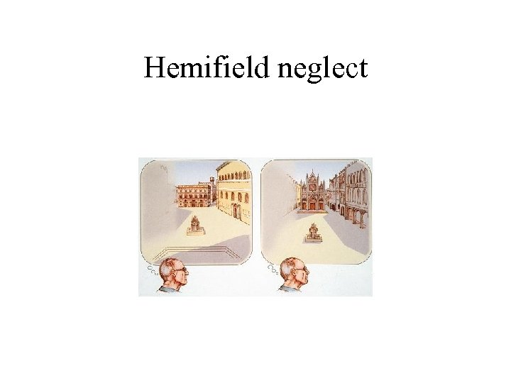 Hemifield neglect 