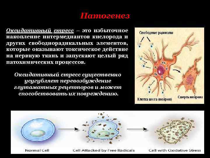 Патогенез Оксидативный стресс – это избыточное накопление интермедиантов кислорода и других свободнорадикальных элементов, которые