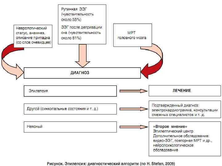 Патогенез эпилепсии схема