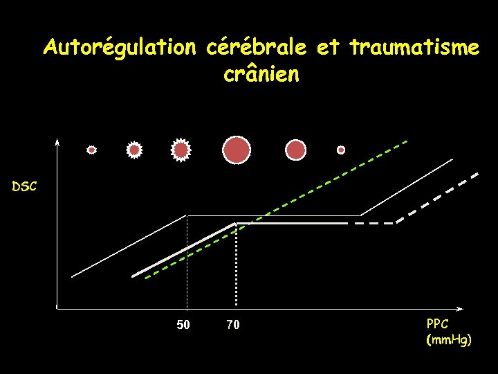 Autorégulation cérébrale et traumatisme crânien DSC 50 70 PPC (mm. Hg) 