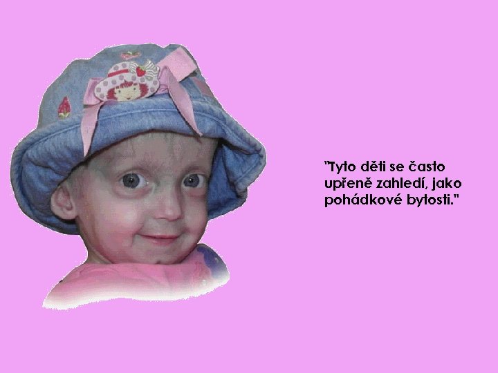 "Tyto děti se často upřeně zahledí, jako pohádkové bytosti. " 