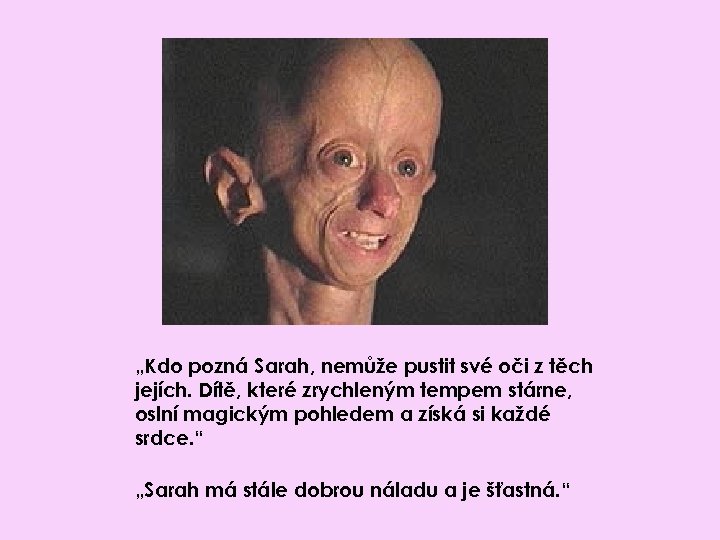 „Kdo pozná Sarah, nemůže pustit své oči z těch jejích. Dítě, které zrychleným tempem