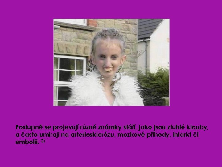 Postupně se projevují různé známky stáří, jako jsou ztuhlé klouby, a často umírají na