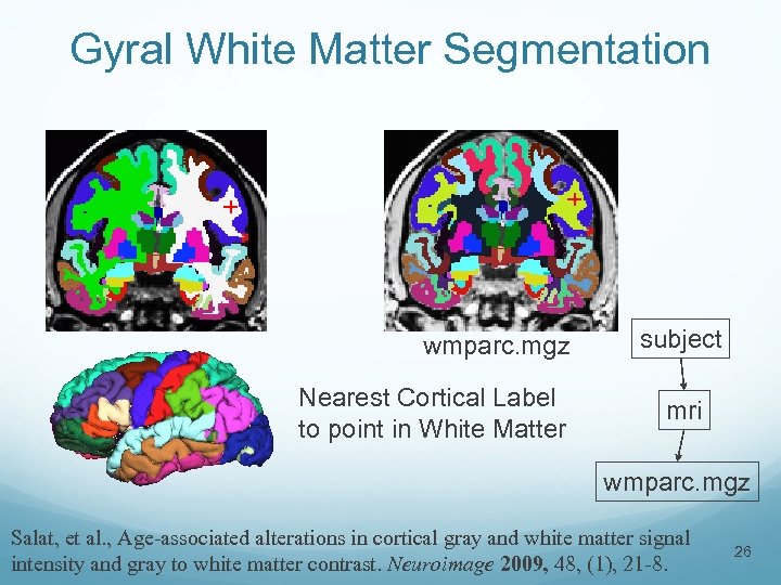 Gyral White Matter Segmentation + + wmparc. mgz Nearest Cortical Label to point in