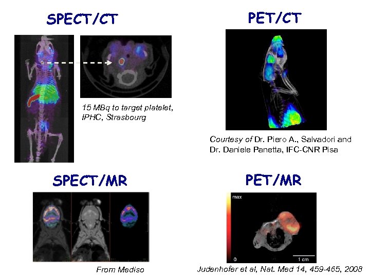 SPECT/CT PET/CT 15 MBq to target platelet, IPHC, Strasbourg Courtesy of Dr. Piero A.