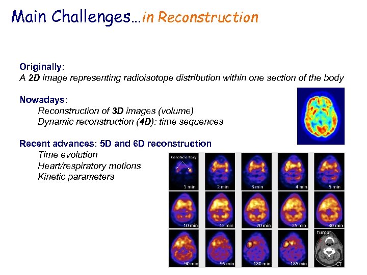 Main Challenges…in Reconstruction Originally: A 2 D image representing radioisotope distribution within one section