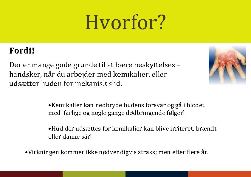 Hvorfor? Fordi! Der er mange gode grunde til at bære beskyttelses – handsker, når