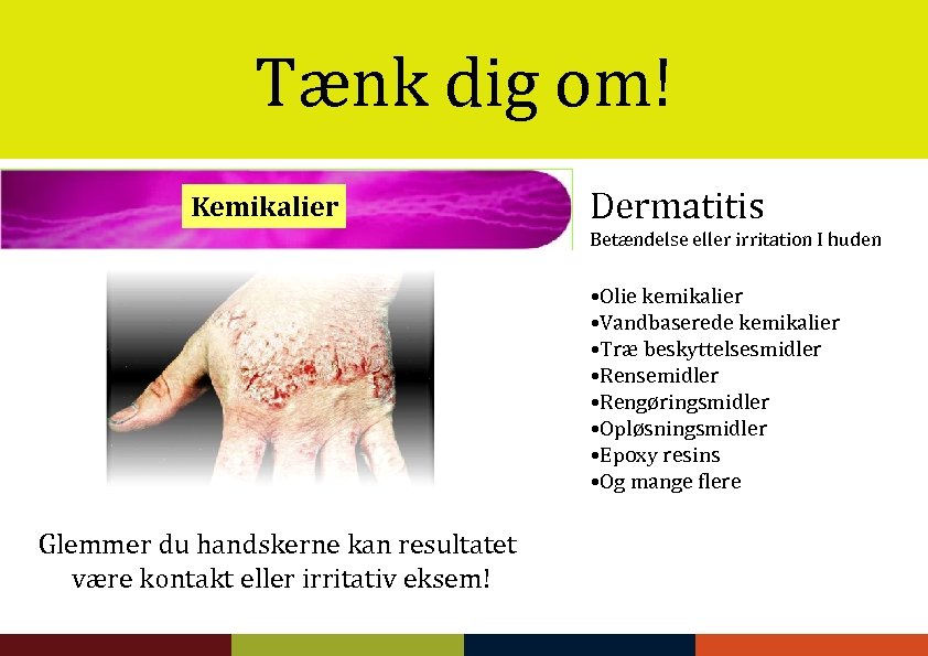 Tænk dig om! Kemikalier Dermatitis Betændelse eller irritation I huden • Olie kemikalier •